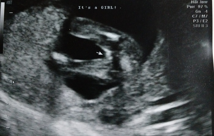 IMG_20190831_225823028_2