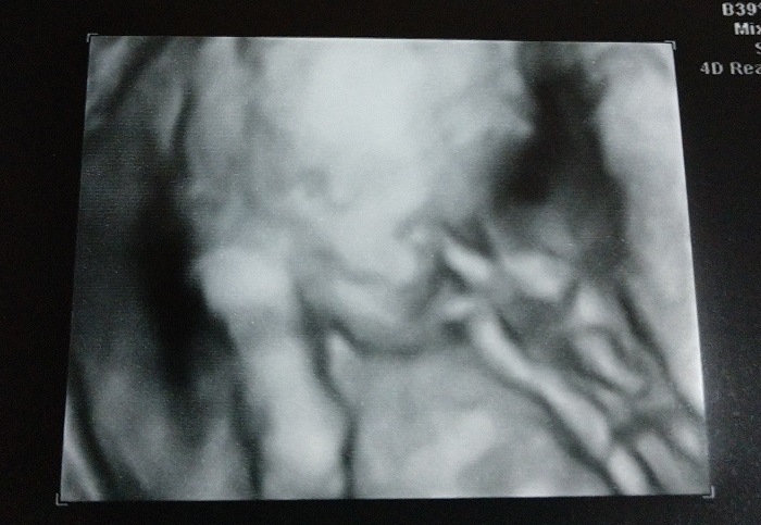 IMG_20190831_225917661_2