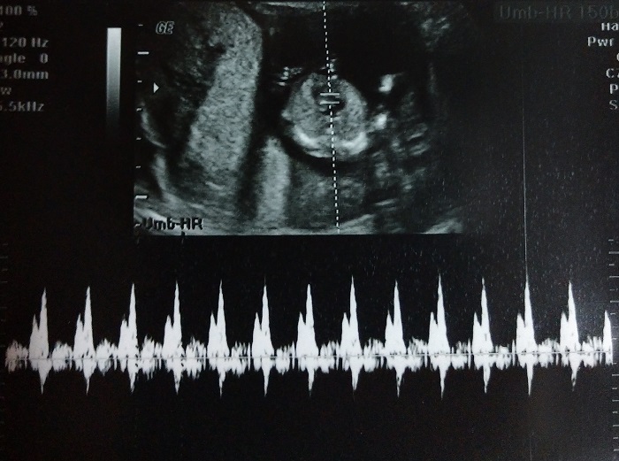 IMG_20190831_225948570_2