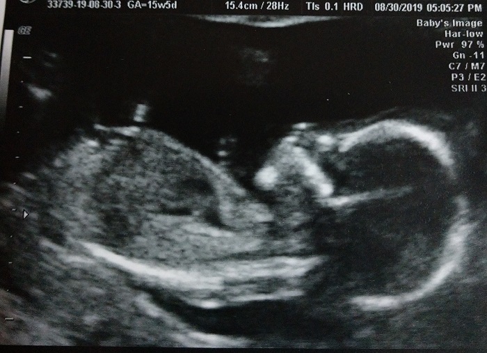 IMG_20190831_230003250_2