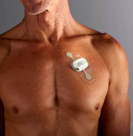 ManwearingZIOpatchProvidenceHealth